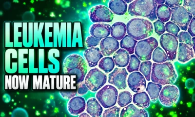 leukemia cells mature with progranulin JAK2