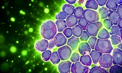 Progranulin JAK2 matures leukemia macrophages Iowa State